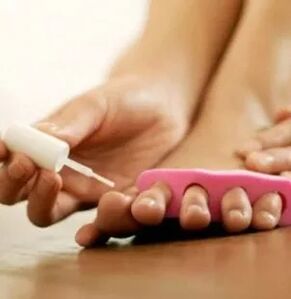 Uporaba terapevtskega laka